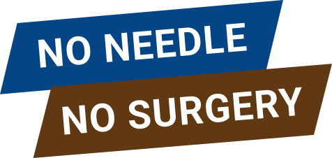 No Needle No Surgery